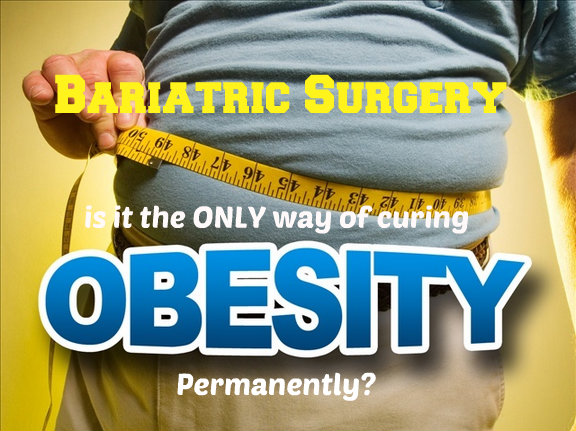 obesity bariatric surgery